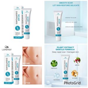 Scars Disappears Cream